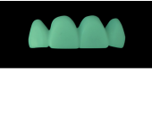 Cod.C19Facing : 15x  wax facings-bridges,  MEDIUM, Square tapering, TOOTH 12-22, compatible with Cod.A19Lingual,TOOTH 12-22 for long-term provisionals preparation